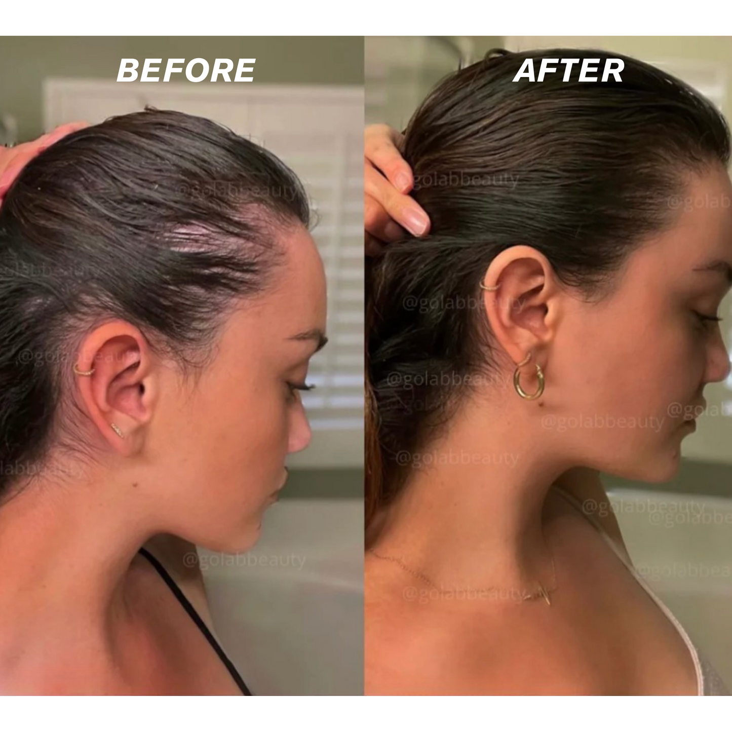 Rosemary Rice Water Hair Spray