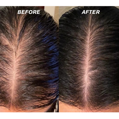 Rosemary Rice Water Hair Spray