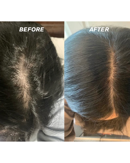 Rosemary Rice Water Hair Spray