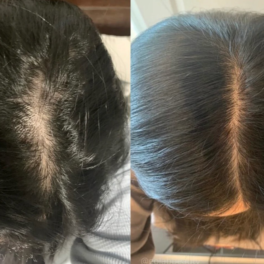 <h2>LOVED BY EVERYONE, EVERYWHERE. DONT MISS OUT</h2>