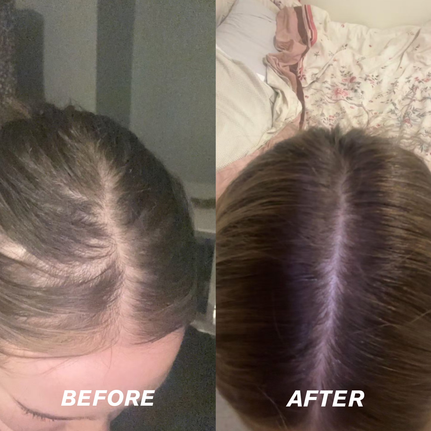 Rosemary Rice Water Hair Spray