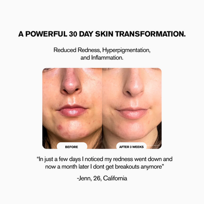 LunorLab High Frequency Wand