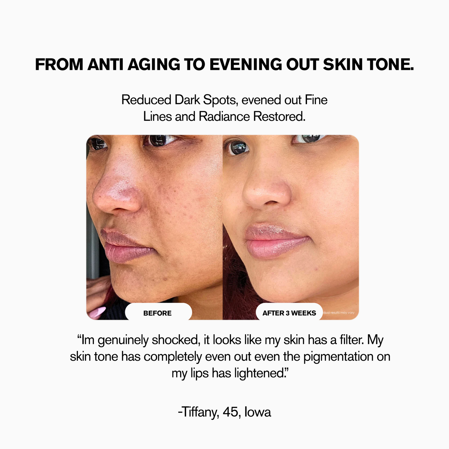 LunorLab High Frequency Wand