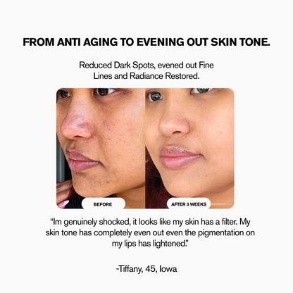 LunorLab High Frequency Wand